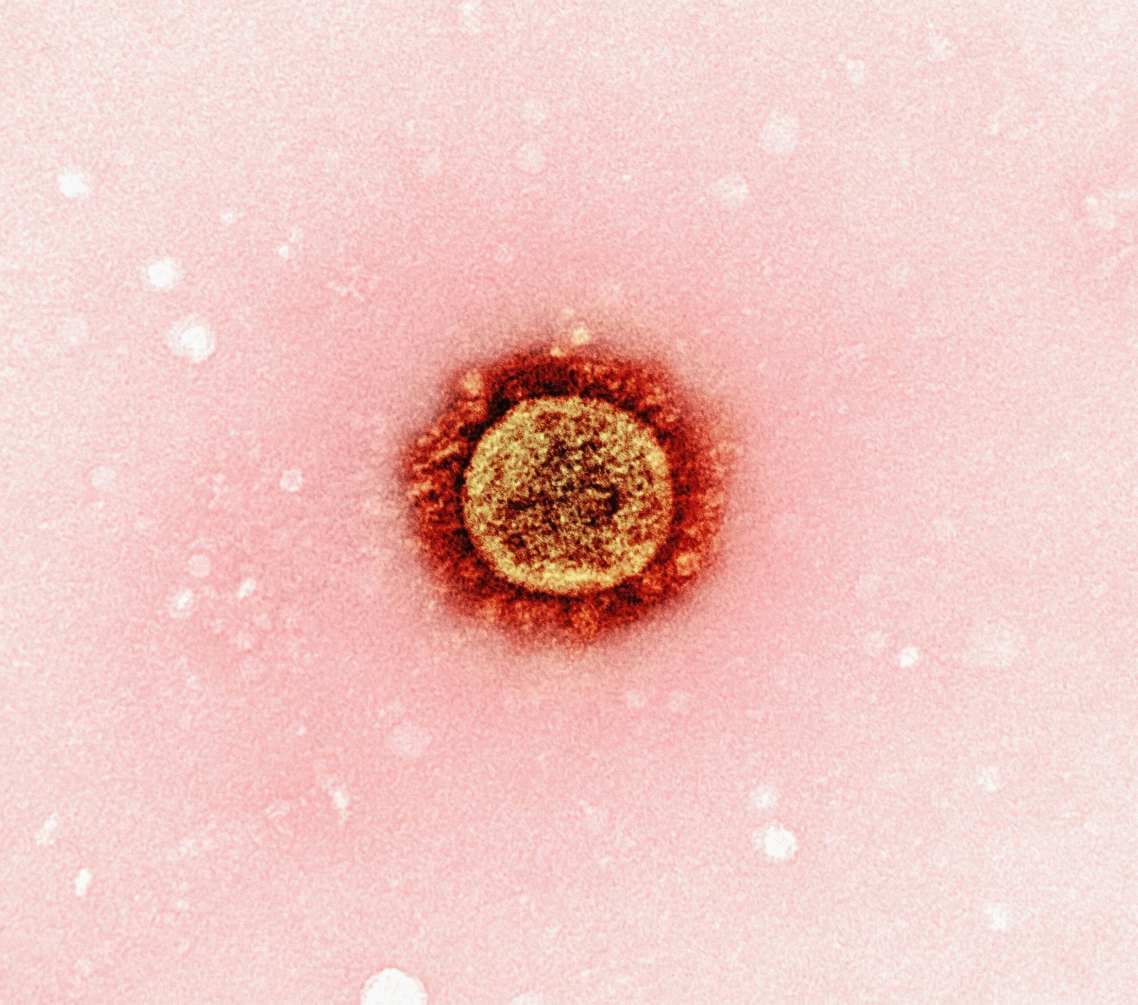 a close up of a red substance on a pink background