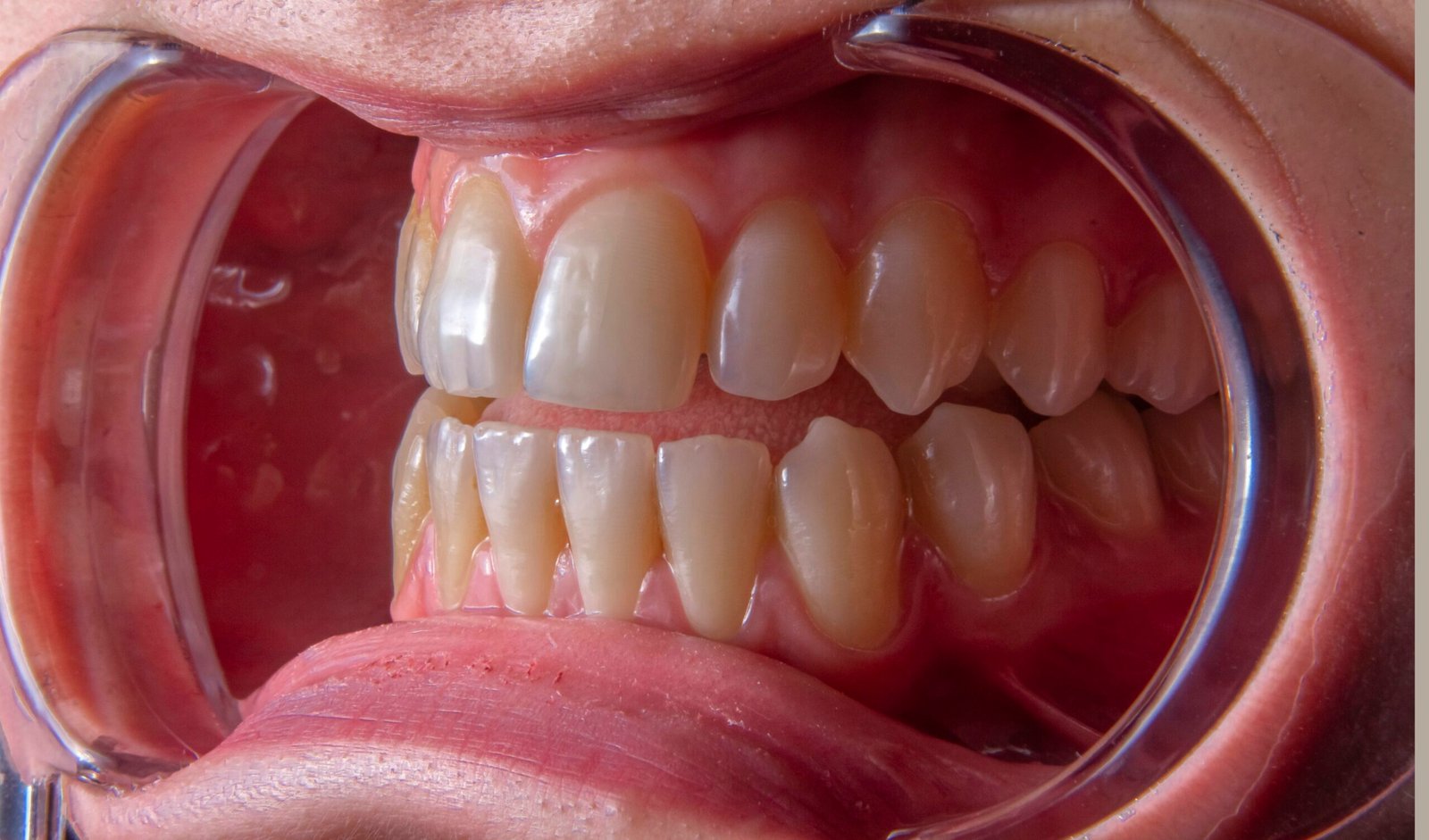 a close-up of a person's mouth
