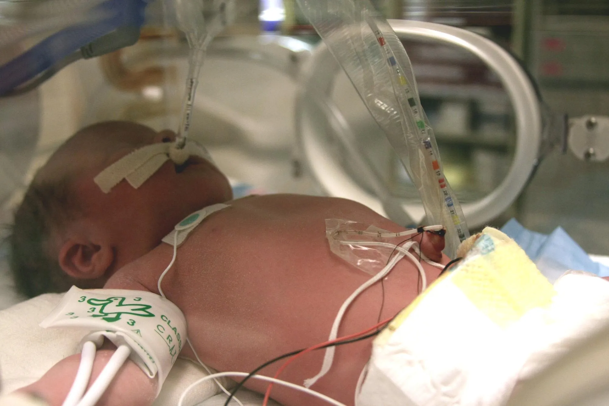 Close-up of baby in incubator