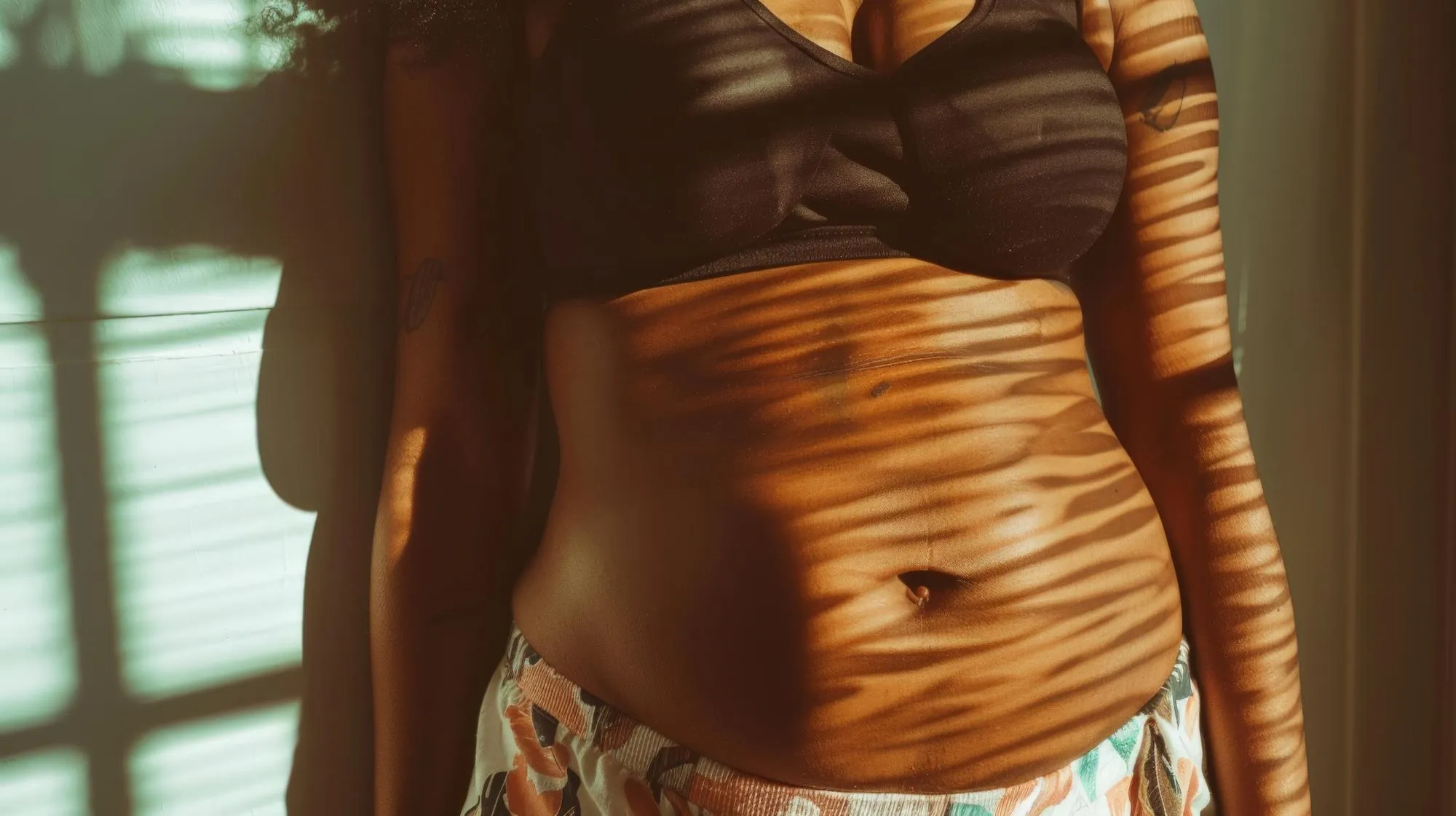 Intimate shot of stretch marks on a woman39s abdomen celebrating natural skin patterns and life stories ar 169 Job ID 6e1494ea189246788531459bc87c2b48