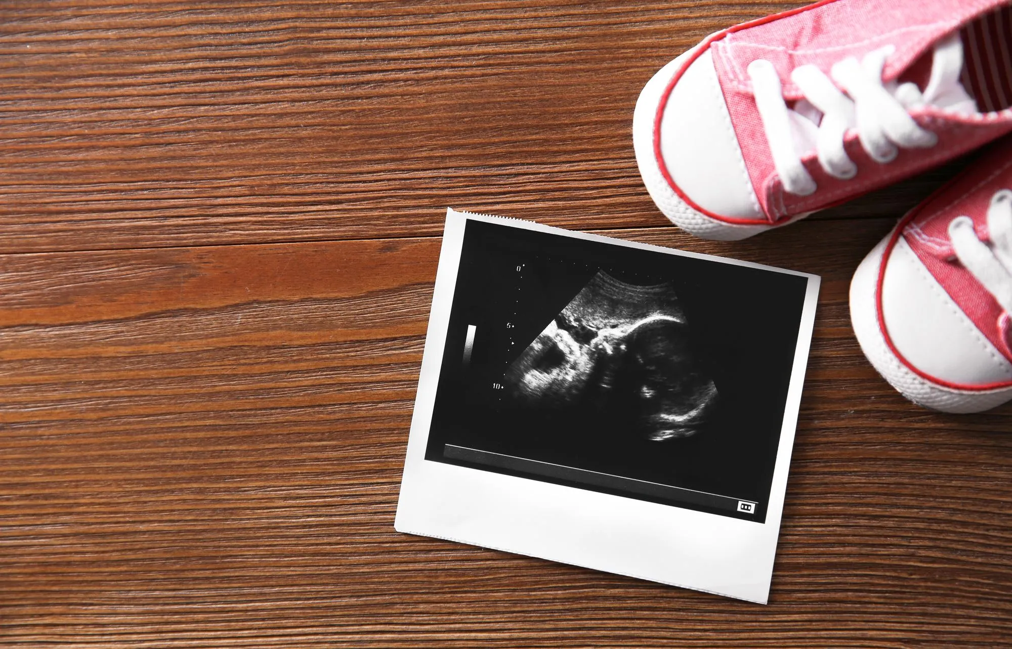 Ultrasound picture and baby shoes on wooden background top view with space for text