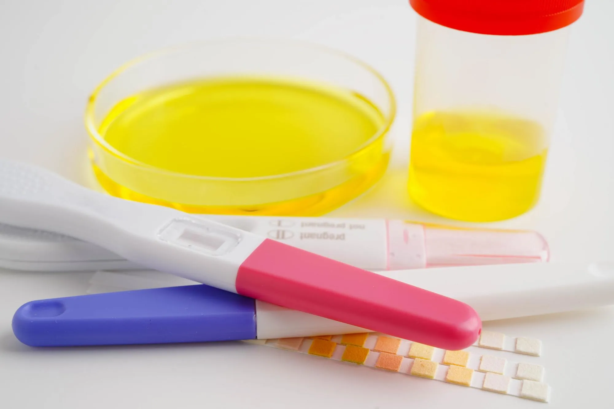 Urinalysis urine cup with reagent strip pH paper test and comparison chart in laboratory