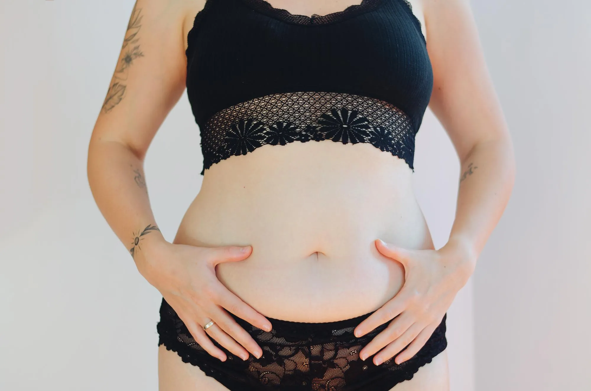 Woman black underwear fat belly overweight body lose weight surgery subcutaneous fat breakdown