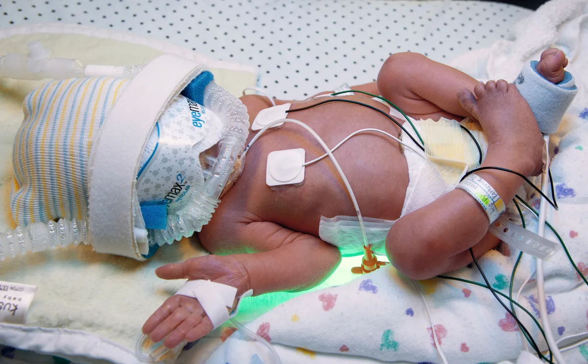 Premature infant in an incubator at the Mcmaster Children's Hospital NICU