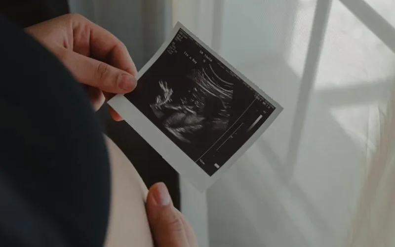Pregnant woman holding an ultrasound scan of her unborn child, symbolizing motherhood.